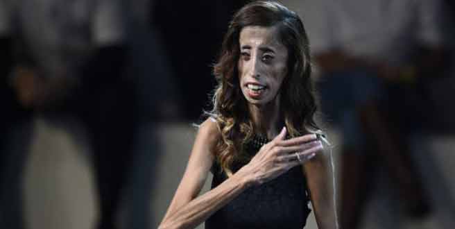 Lizzie Velásquez, la mujer más fea del mundo