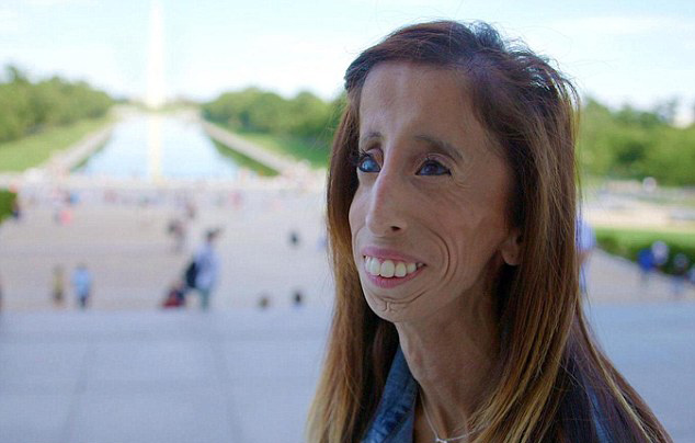 Lizzie Velásquez, la mujer más fea del mundo