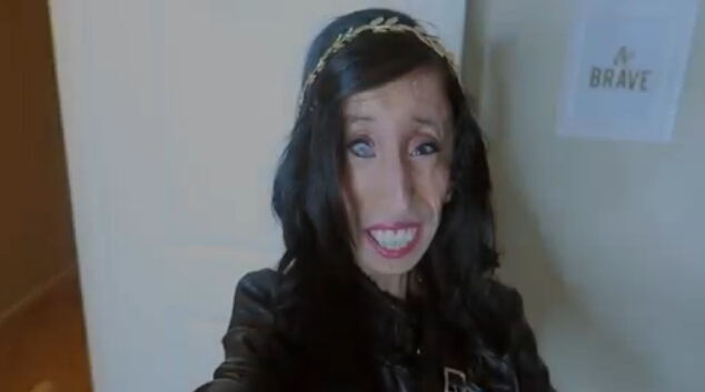 Lizzie Velásquez, la mujer más fea del mundo