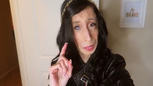 Lizzie Velásquez, la mujer más fea del mundo