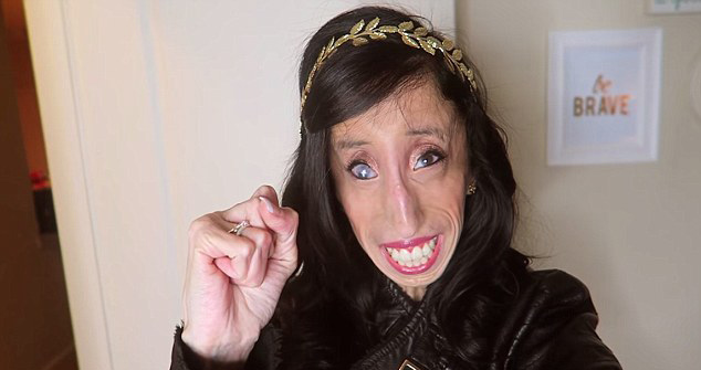 Lizzie Velásquez, la mujer más fea del mundo