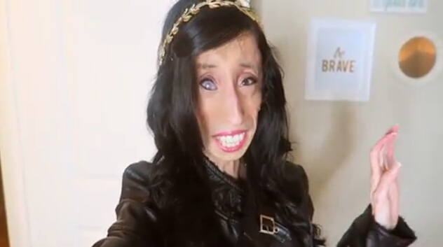 Lizzie Velásquez, la mujer más fea del mundo