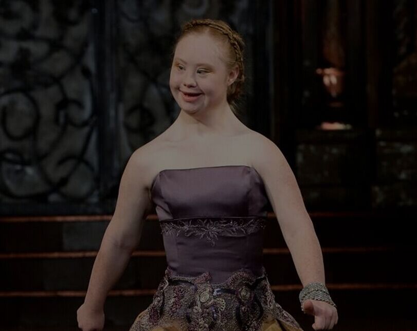 Joven con Síndrome de Down es modelo profesional