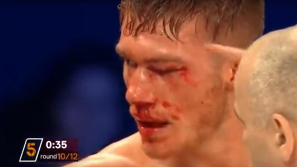 El boxeador Nick Blackwell, en coma inducido tras un combate