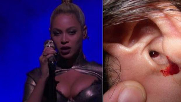 Beyoncé empieza a sangrar en un concierto