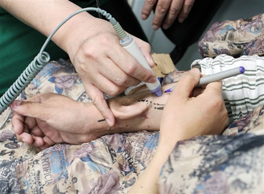 Cirujanos chinos trasplantan oreja regenerada de brazo a cabeza